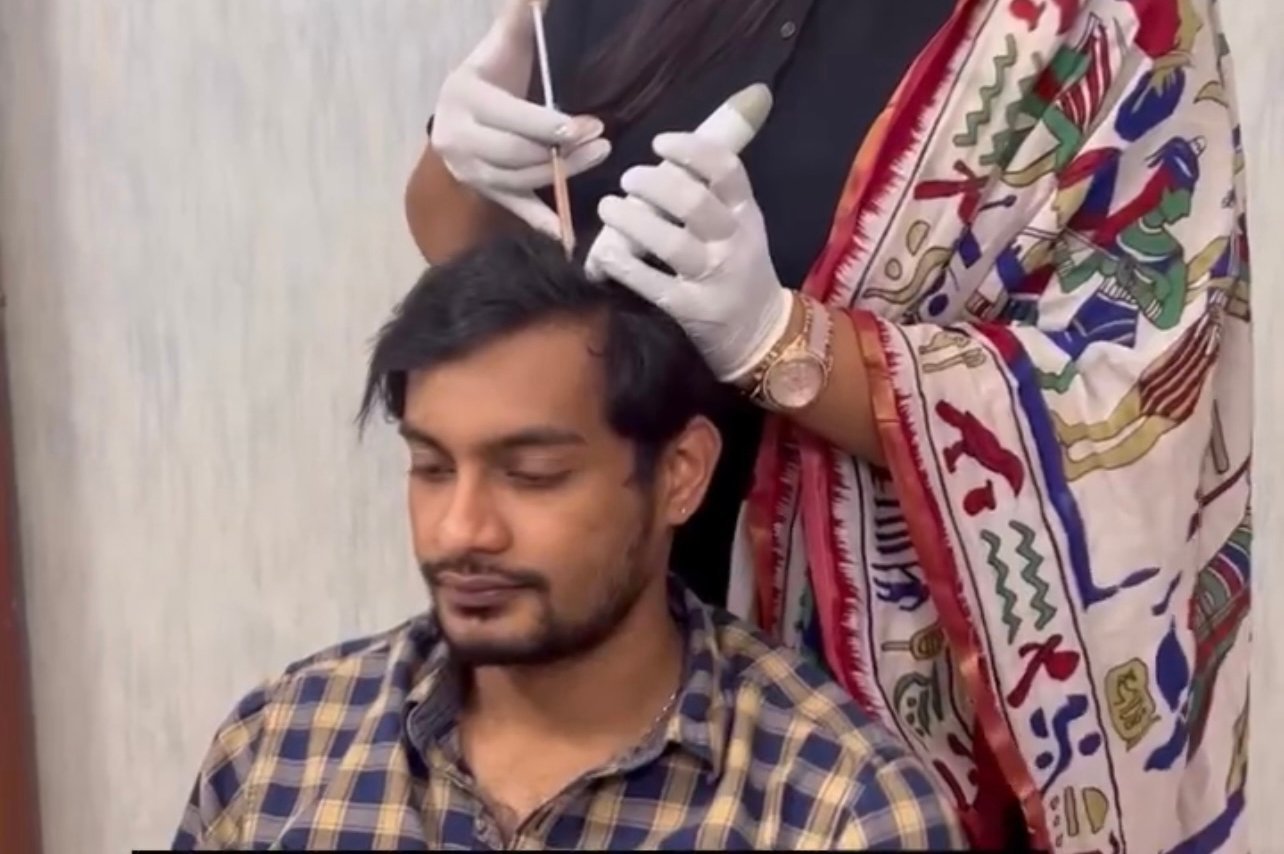 Doctor examining the scalp at Transformance Hyderabad
