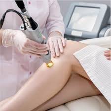 female laser hair removal Hyderabad