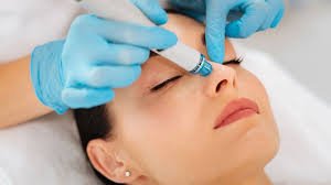 Best Hydrafacial Treatment in Hyderabad